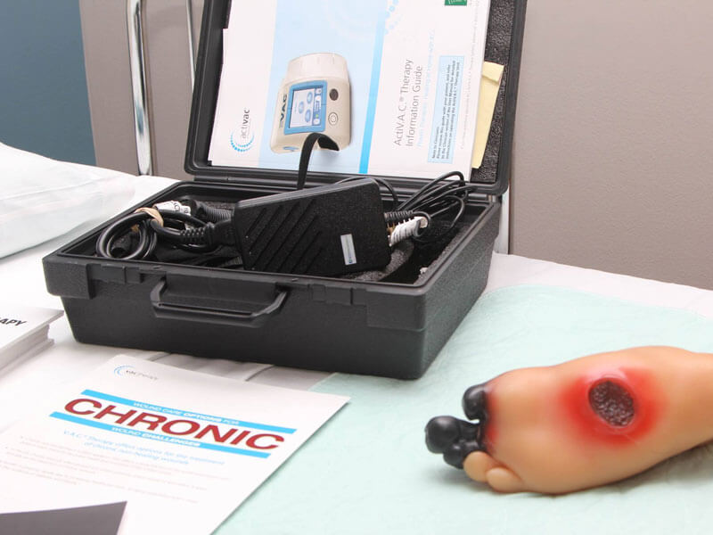 medical equipment and diorama for ulcers