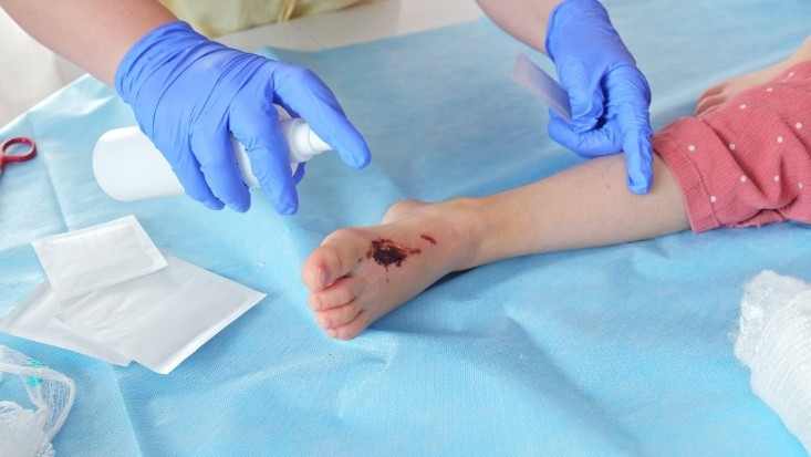 Doctor is taking Care of the Bone Infection Wound